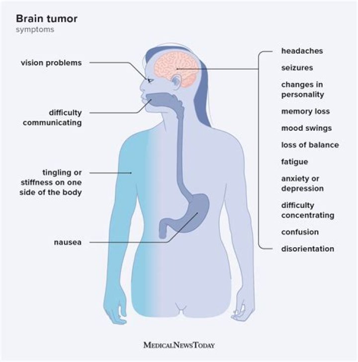 Can a brain tumor cause facial numbness?