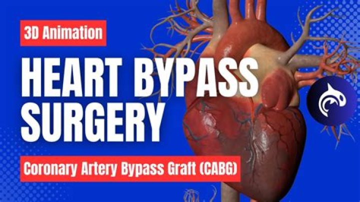 Can you live 20 years after bypass surgery?