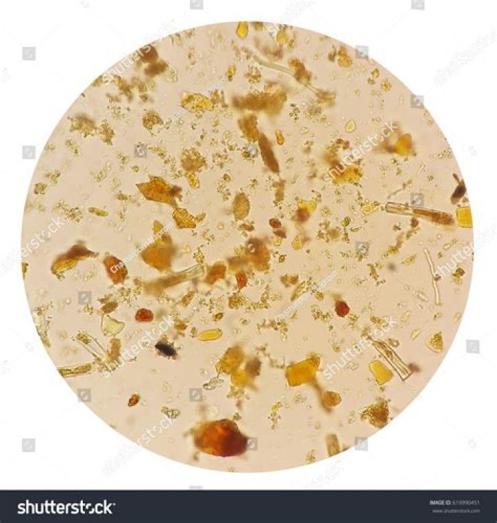 Do parasites like fruit?