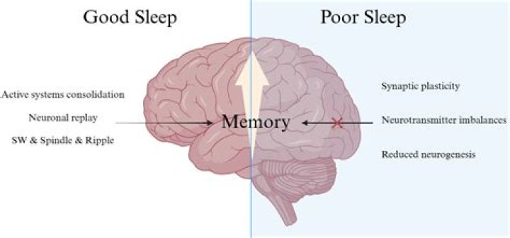 Does epilepsy make you sleep more?