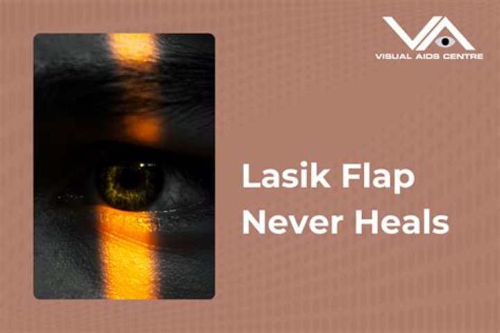 Does LASIK flap never fully heal?