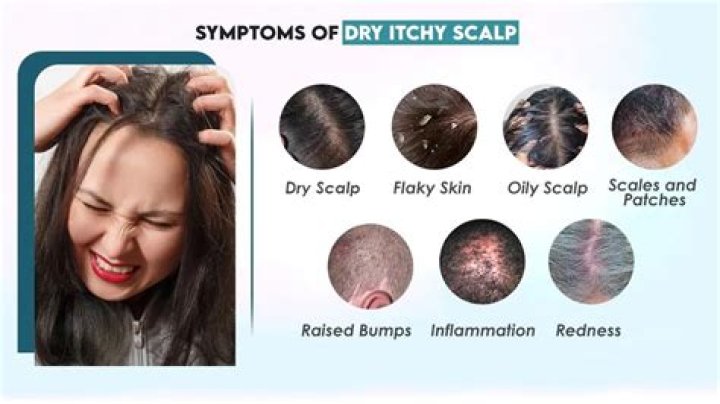 Does let down feel itchy?