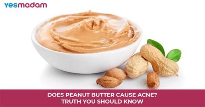 Does peanut butter cause hair loss?