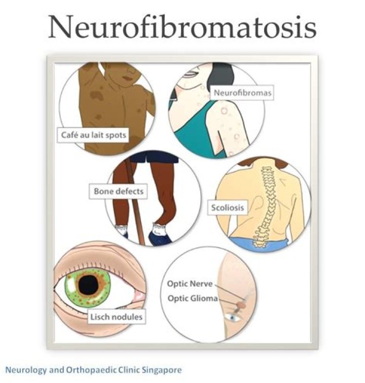 How common is Schwannomatosis?