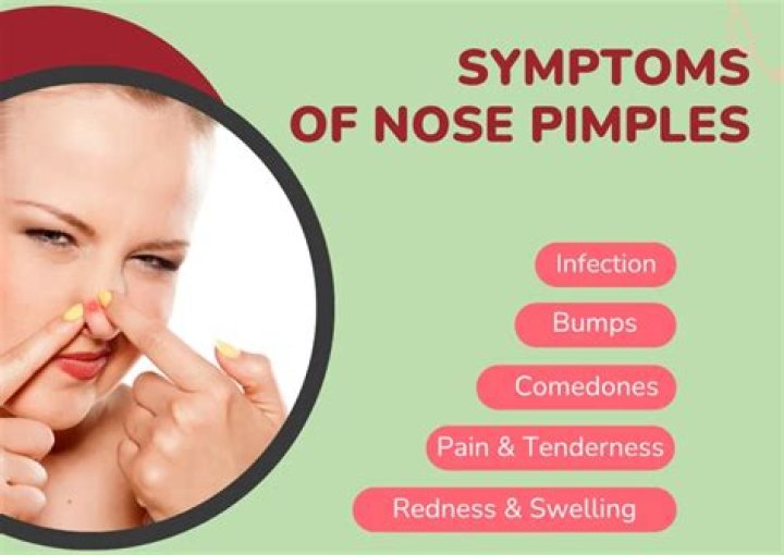 How do I get rid of a pimple inside my nose?