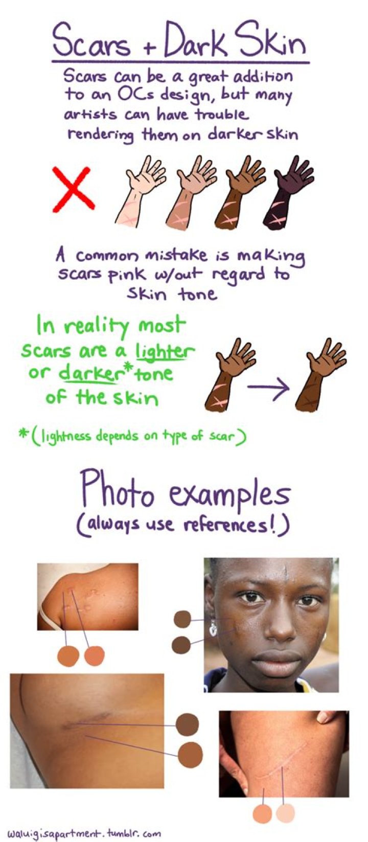 How do you lighten dark skin scars?