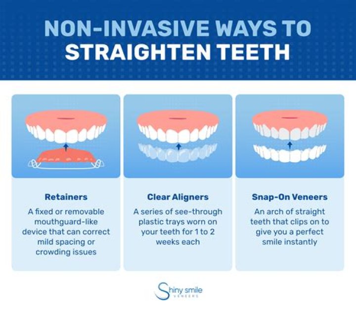 How do you straighten Kids teeth?
