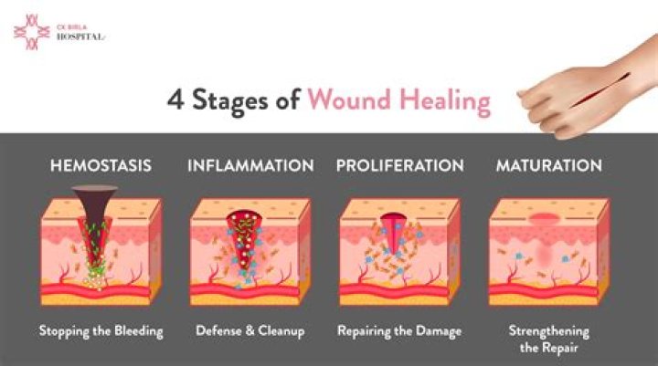 How do you tell if a wound is not healing?