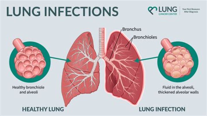 How long does lung washing take?