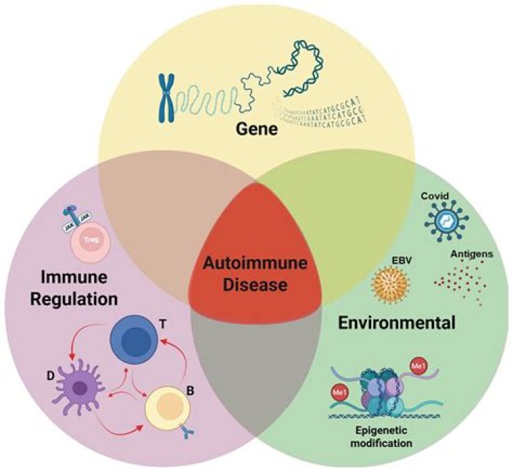 Is epilepsy an autoimmune disease?