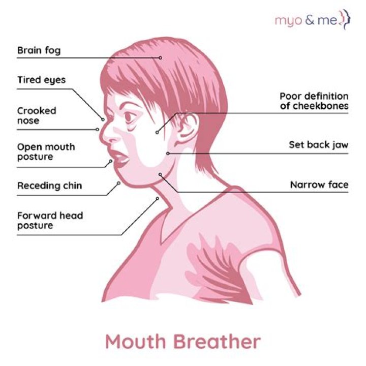 Is it better to breathe through your nose or mouth when running?