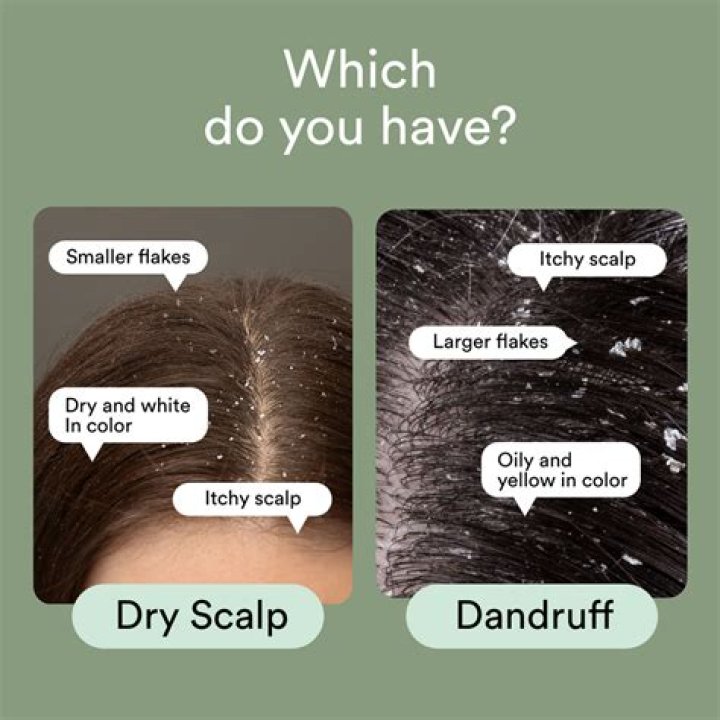 Is it good to scratch dandruff?