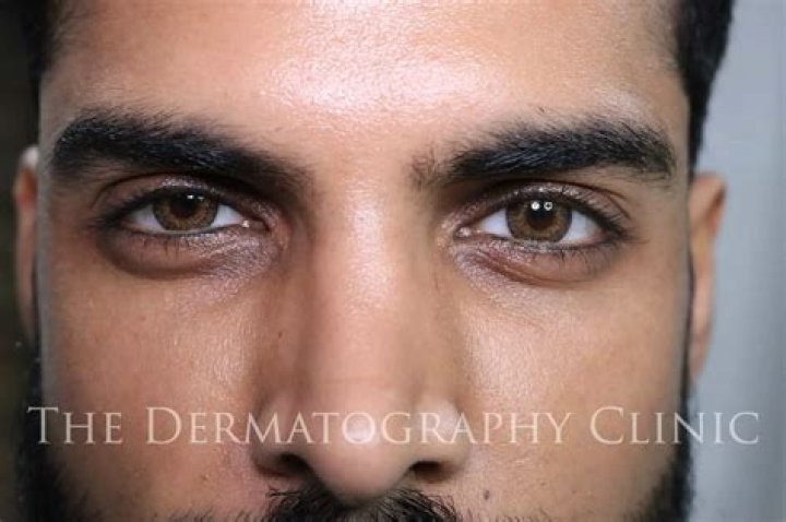 Is kohl eyeliner good for eyes?
