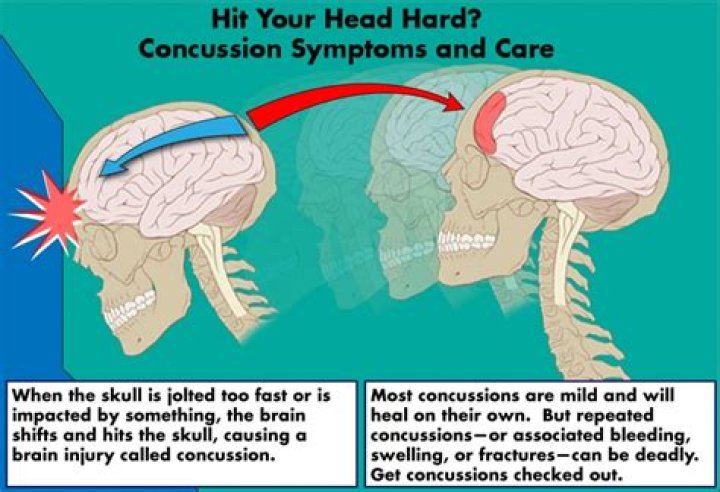 What happens if you hit the back of your head?