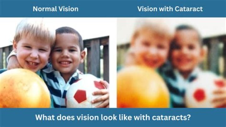 What is 0.1 vision?
