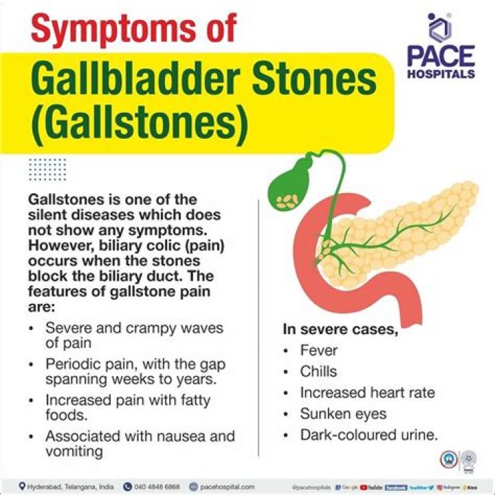What medication dissolves gallstones?