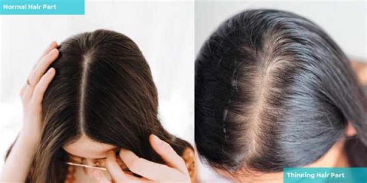 Why is my hair snapping at the top?